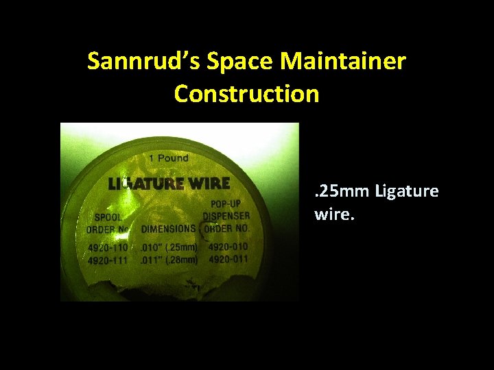 Sannrud’s Space Maintainer Construction . 25 mm Ligature wire. 