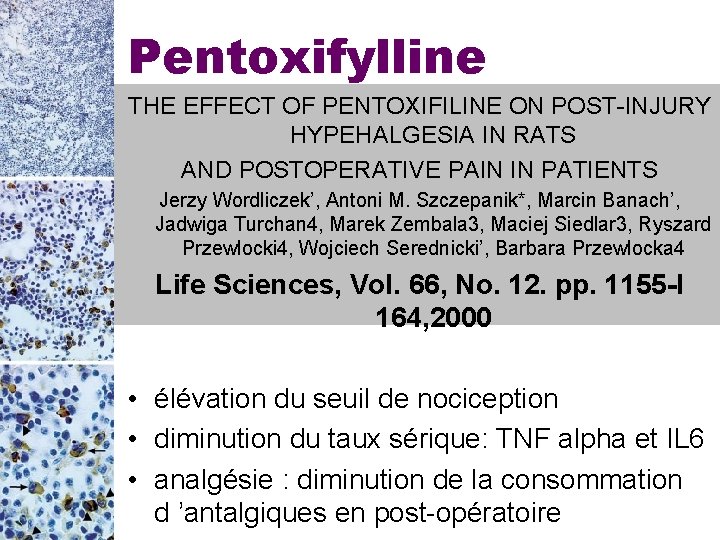 Pentoxifylline THE EFFECT OF PENTOXIFILINE ON POST-INJURY HYPEHALGESIA IN RATS AND POSTOPERATIVE PAIN IN