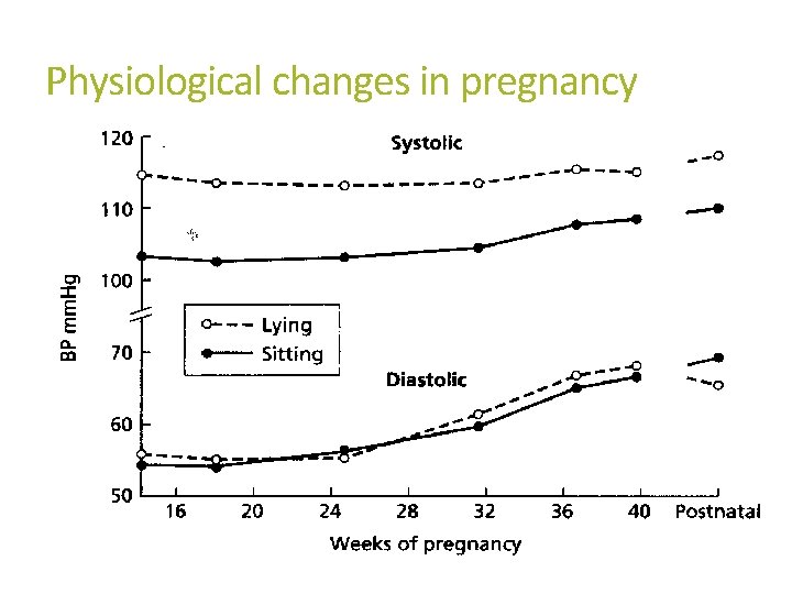 Physiological changes in pregnancy Peripheral vascular resistance falls by 50% MAP falls by 10