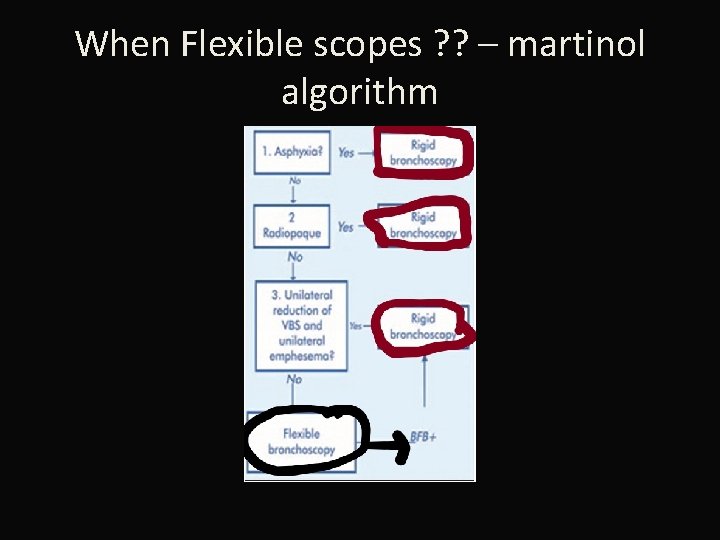 When Flexible scopes ? ? – martinol algorithm 
