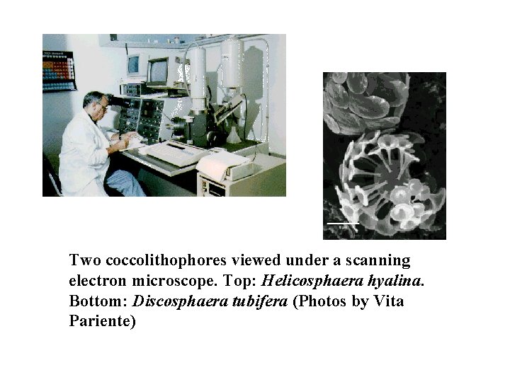 Two coccolithophores viewed under a scanning electron microscope. Top: Helicosphaera hyalina. Bottom: Discosphaera tubifera