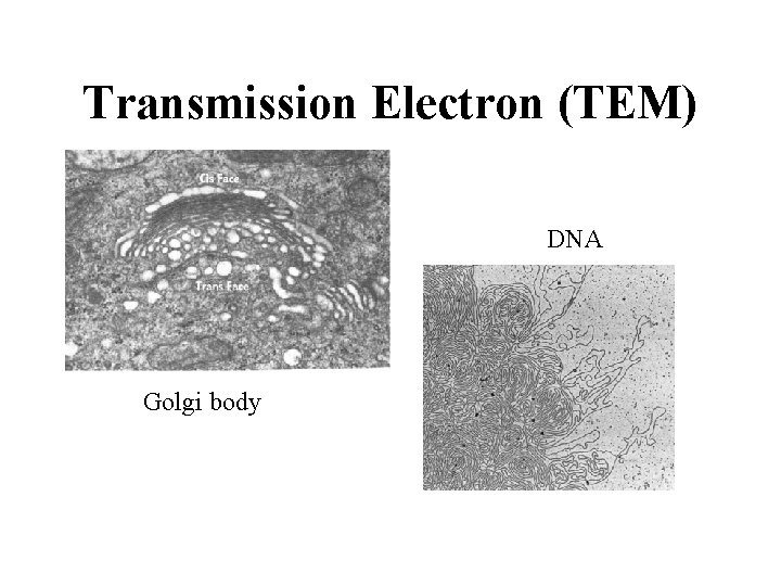 Transmission Electron (TEM) DNA Golgi body 