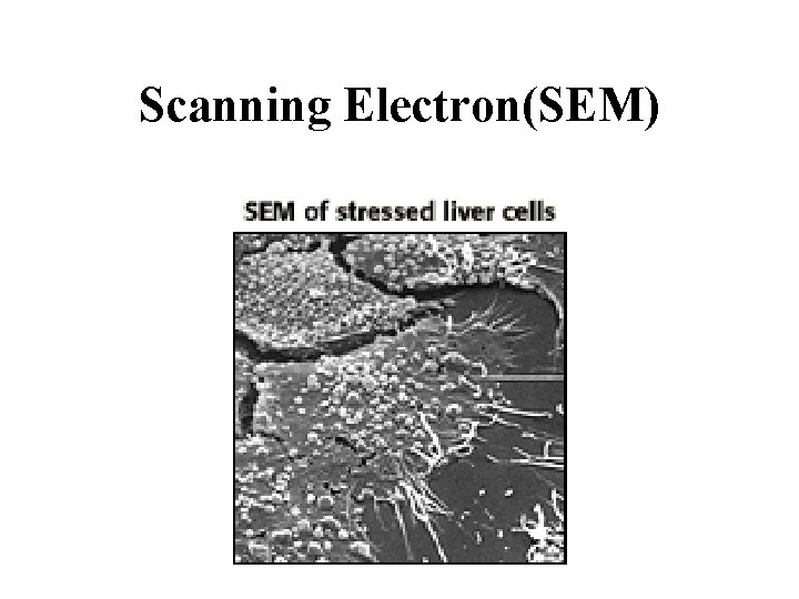 Scanning Electron(SEM) 