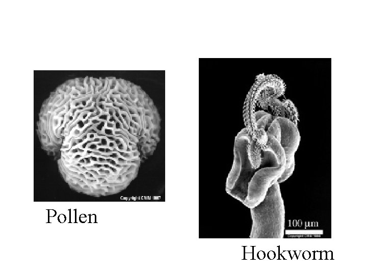 Pollen Hookworm 