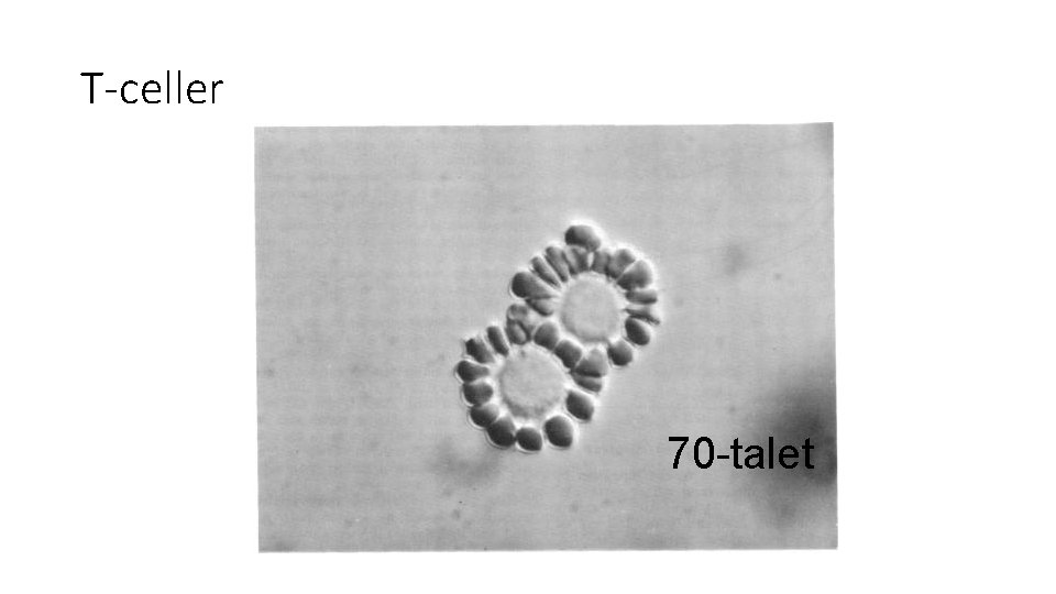 T-celler 70 -talet 