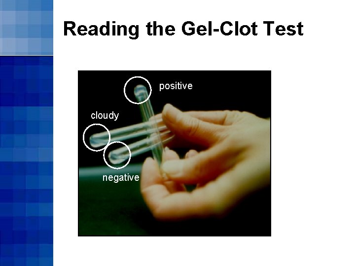 Reading the Gel-Clot Test positive cloudy negative 