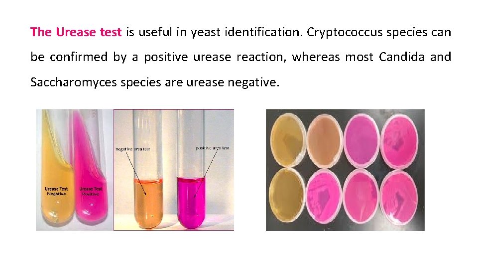 The Urease test is useful in yeast identification. Cryptococcus species can be confirmed by