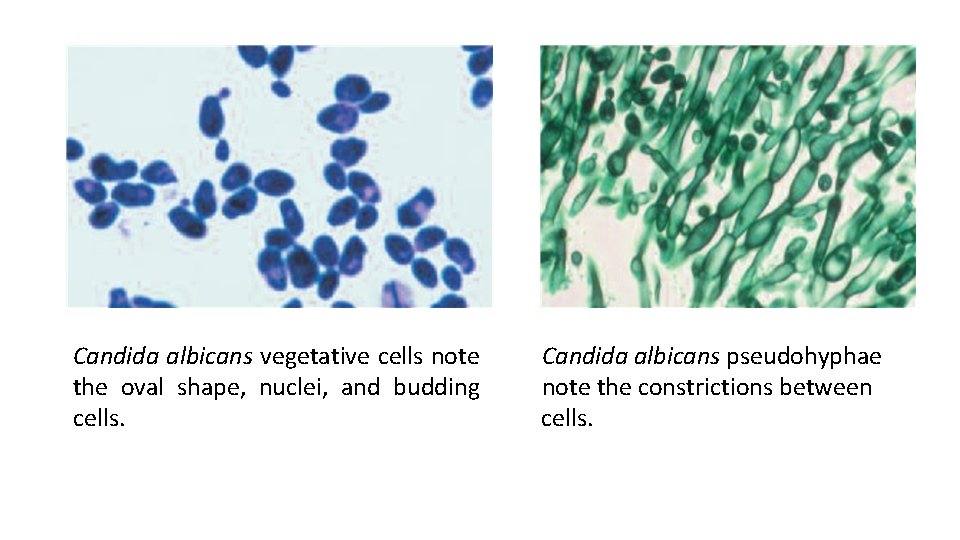Candida albicans vegetative cells note the oval shape, nuclei, and budding cells. Candida albicans