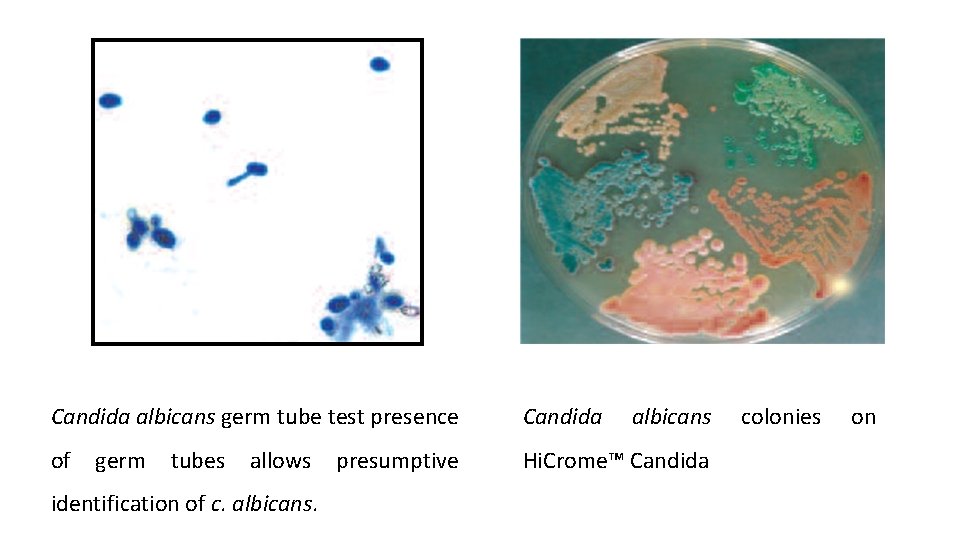 Candida albicans germ tube test presence Candida of Hi. Crome™ Candida germ tubes allows