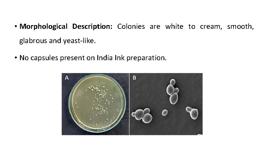  • Morphological Description: Colonies are white to cream, smooth, glabrous and yeast-like. •