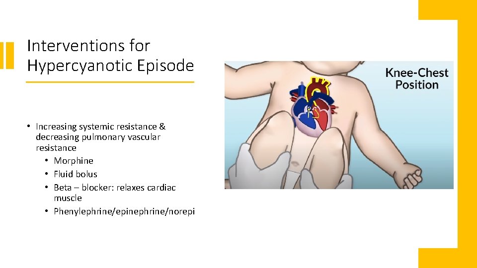 Interventions for Hypercyanotic Episode • Increasing systemic resistance & decreasing pulmonary vascular resistance •