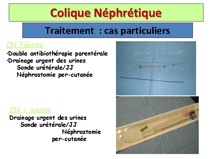 Colique Néphrétique Traitement : cas particuliers CN Fébrile • Double antibiothérapie parentérale • Drainage