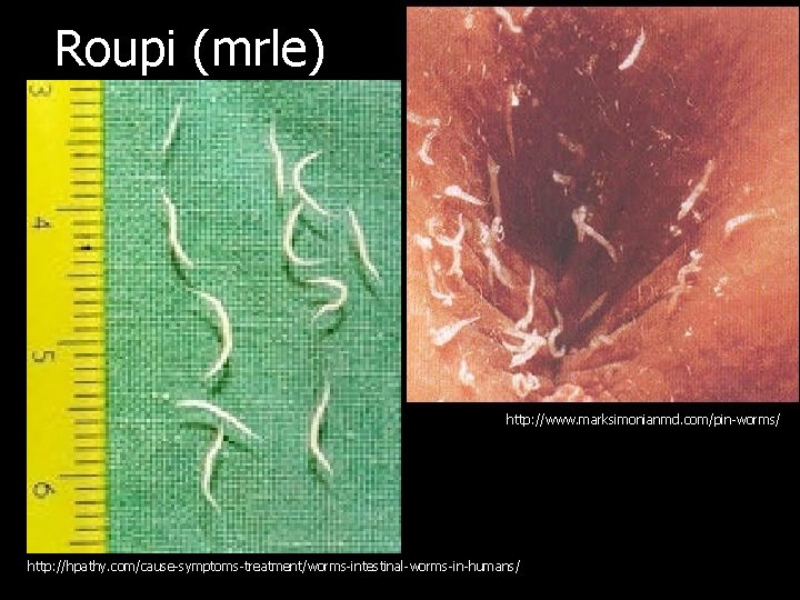 Roupi (mrle) http: //www. marksimonianmd. com/pin-worms/ http: //hpathy. com/cause-symptoms-treatment/worms-intestinal-worms-in-humans/ 