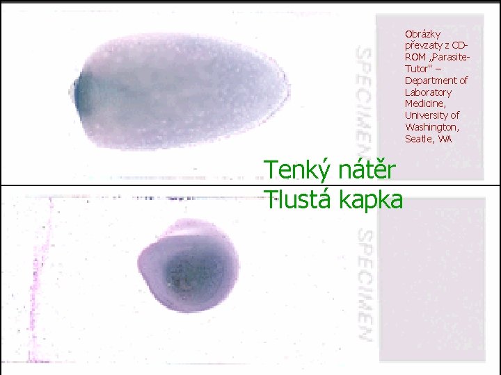 Obrázky převzaty z CDROM „Parasite. Tutor“ – Department of Laboratory Medicine, University of Washington,