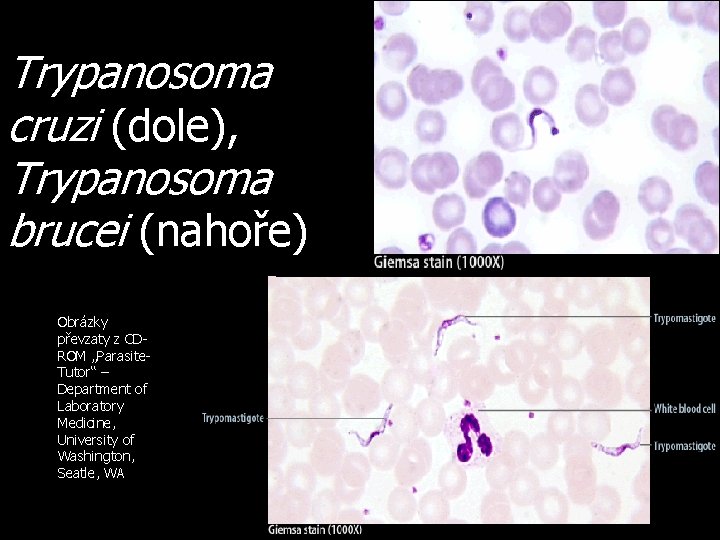 Trypanosoma cruzi (dole), Trypanosoma brucei (nahoře) Obrázky převzaty z CDROM „Parasite. Tutor“ – Department