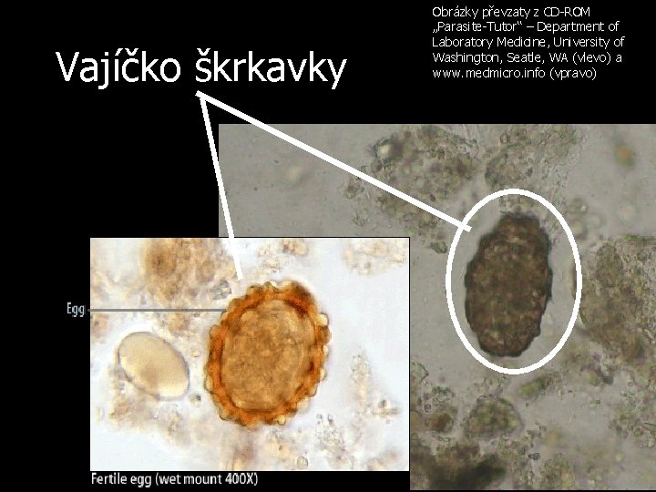 Vajíčko škrkavky Obrázky převzaty z CD-ROM „Parasite-Tutor“ – Department of Laboratory Medicine, University of