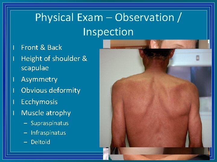 Physical Exam – Observation / Inspection l l l Front & Back Height of