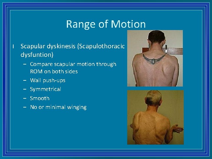 Range of Motion l Scapular dyskinesis (Scapulothoracic dysfuntion) – Compare scapular motion through ROM