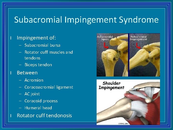Subacromial Impingement Syndrome l Impingement of: – Subacromial bursa – Rotator cuff muscles and