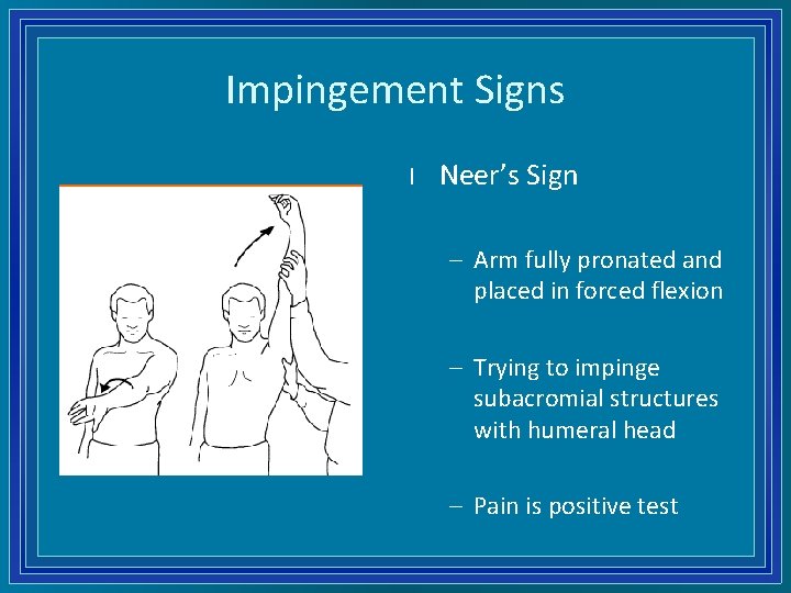 Impingement Signs l Neer’s Sign – Arm fully pronated and placed in forced flexion