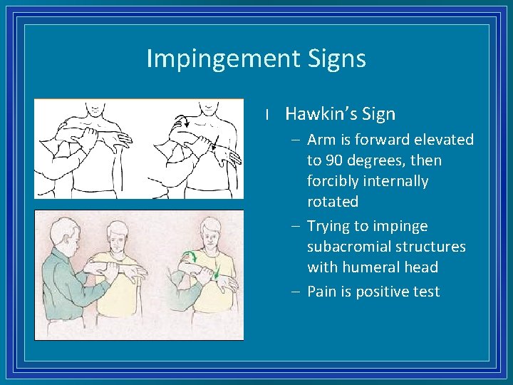 Impingement Signs l Hawkin’s Sign – Arm is forward elevated to 90 degrees, then