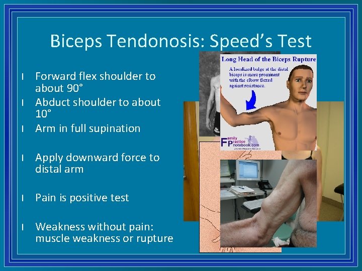 Biceps Tendonosis: Speed’s Test l l l Forward flex shoulder to about 90° Abduct