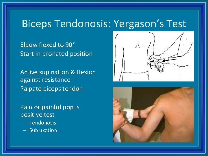 Biceps Tendonosis: Yergason’s Test l l l Elbow flexed to 90° Start in pronated
