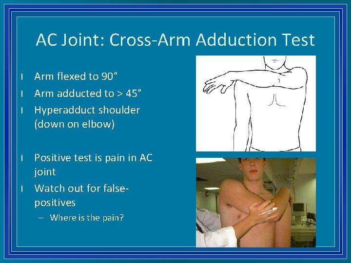 AC Joint: Cross-Arm Adduction Test l l l Arm flexed to 90° Arm adducted
