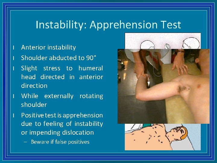 Instability: Apprehension Test l l l Anterior instability Shoulder abducted to 90° Slight stress