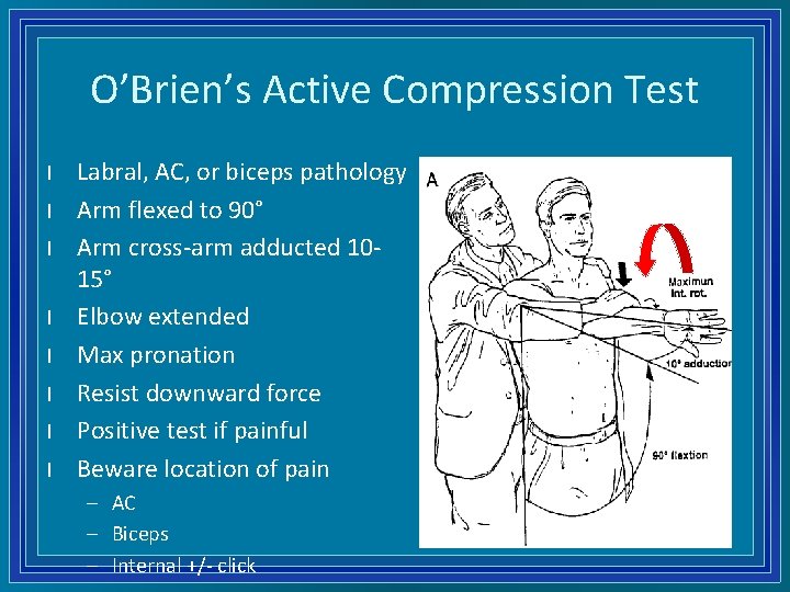 O’Brien’s Active Compression Test l l l l Labral, AC, or biceps pathology Arm
