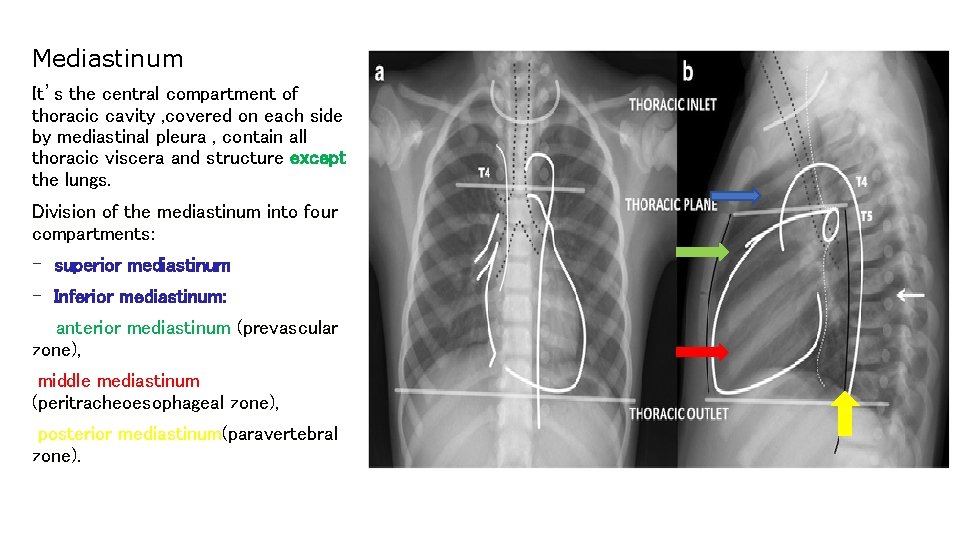 Mediastinum It’s the central compartment of thoracic cavity , covered on each side by