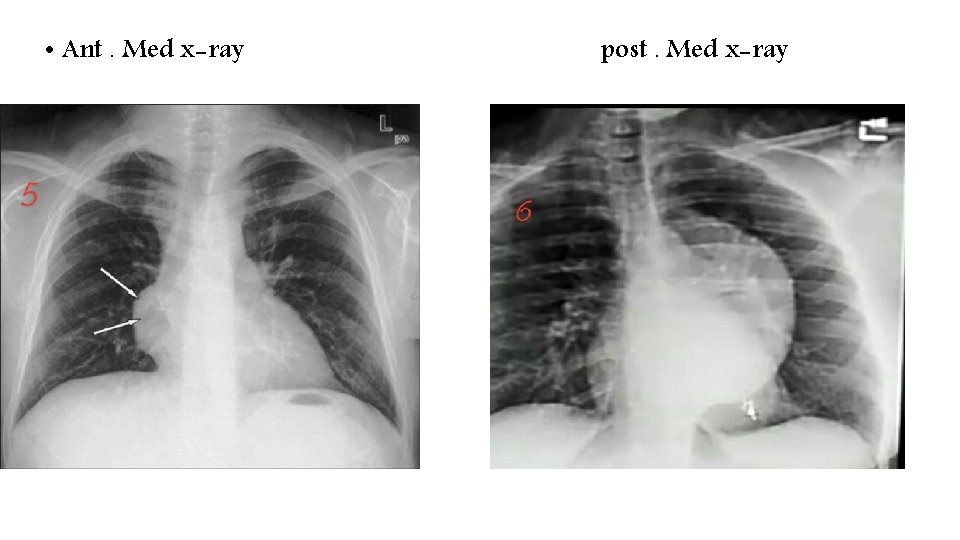  • Ant. Med x-ray post. Med x-ray 