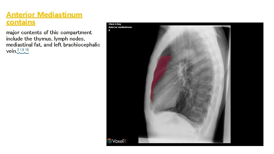 Anterior Mediastinum contains major contents of this compartment include thymus, lymph nodes, mediastinal fat,