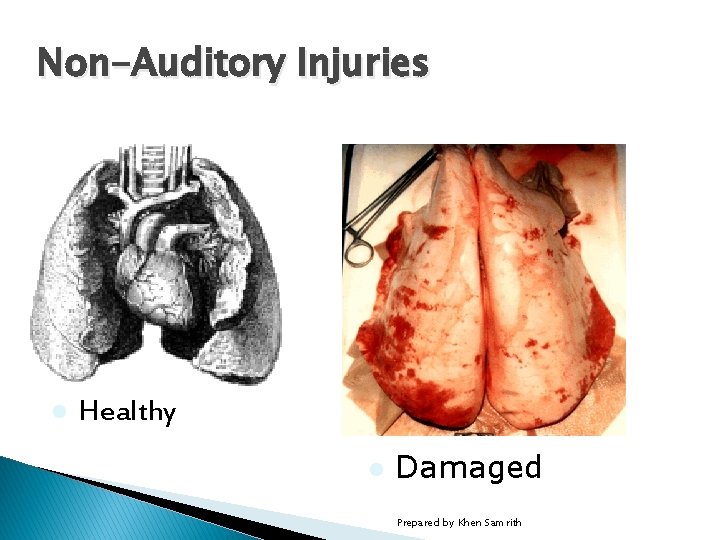 Non-Auditory Injuries � Picture l of a damaged sheep lung Healthy l Damaged Prepared