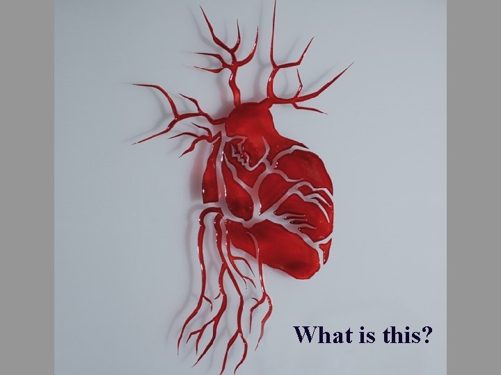 What is this? 