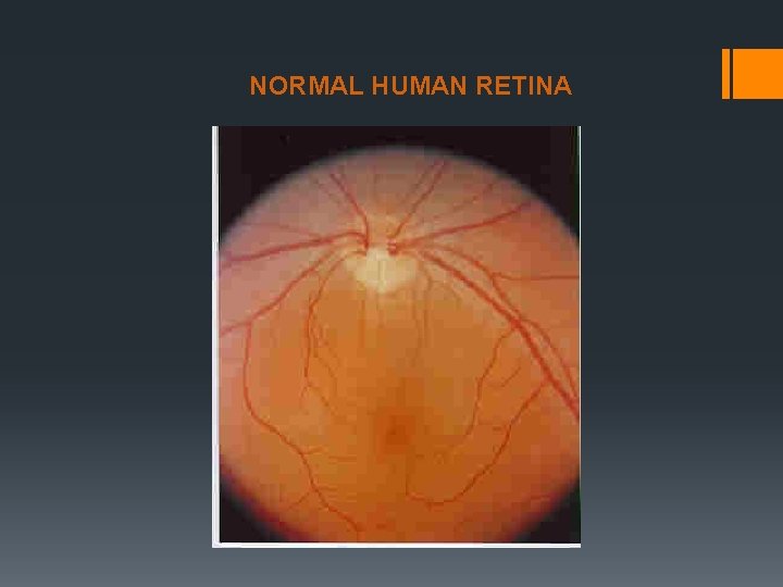 NORMAL HUMAN RETINA 