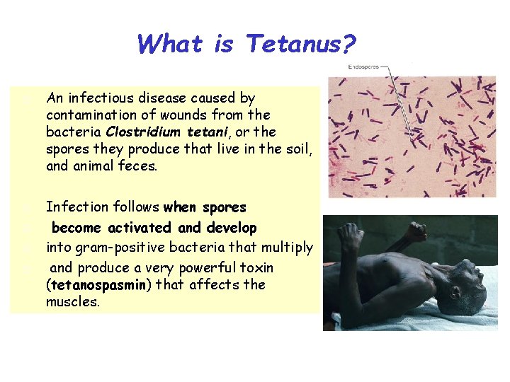 What is Tetanus? An infectious disease caused by contamination of wounds from the bacteria