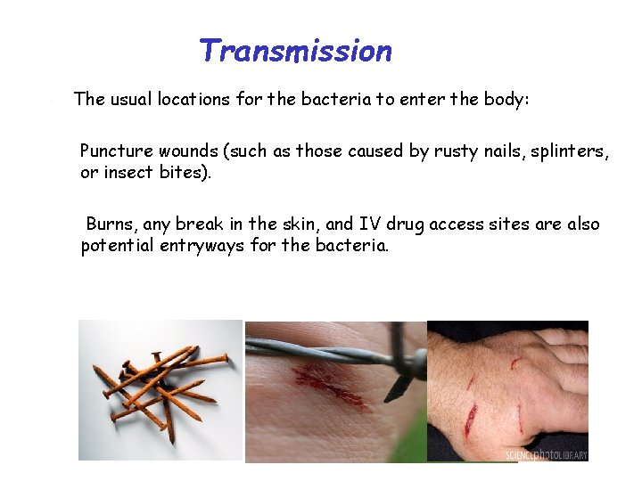 Transmission • The usual locations for the bacteria to enter the body: Puncture wounds