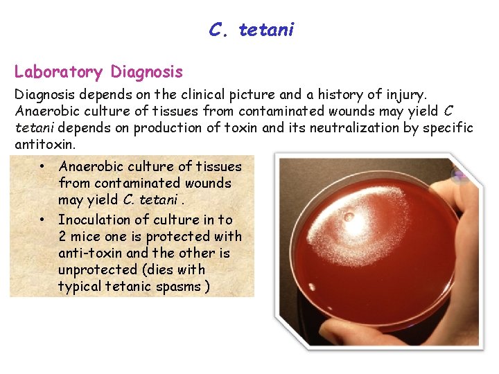 C. tetani Laboratory Diagnosis depends on the clinical picture and a history of injury.