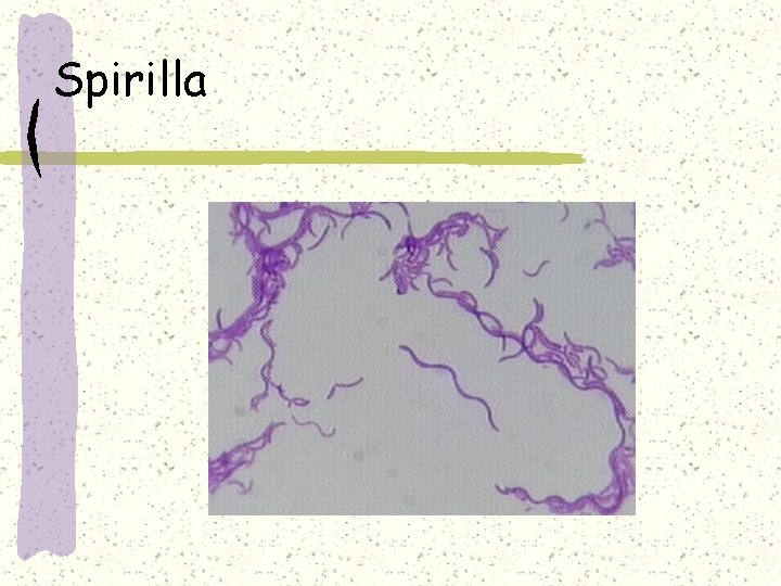 Spirilla 