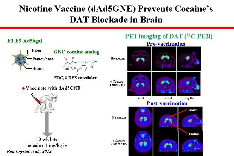 Nicotine Vaccine (d. Ad 5 GNE) Prevents Cocaine’s DAT Blockade in Brain PET imaging