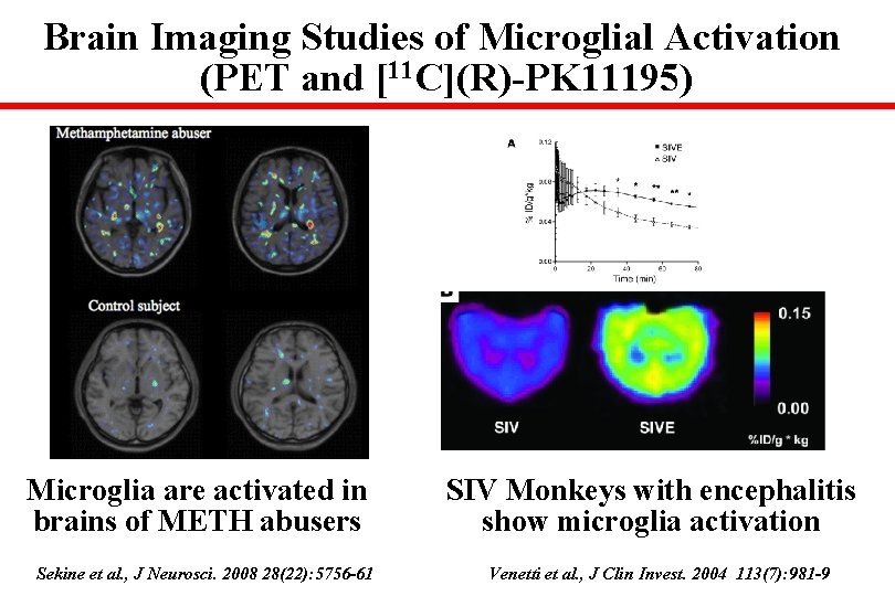 Brain Imaging Studies of Microglial Activation (PET and [11 C](R)-PK 11195) Microglia are activated