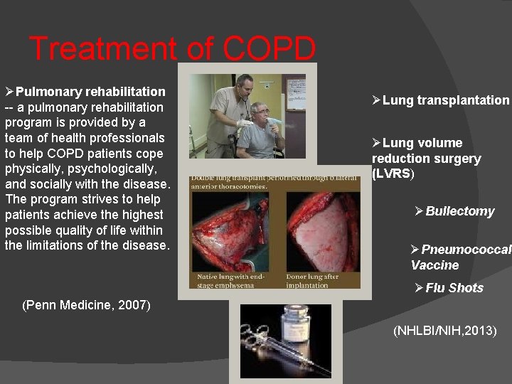 Treatment of COPD ØPulmonary rehabilitation -- a pulmonary rehabilitation program is provided by a