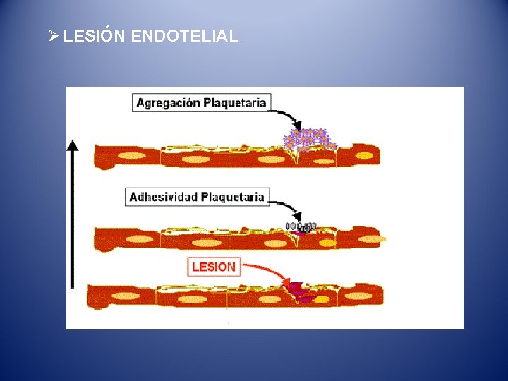 Ø LESIÓN ENDOTELIAL 