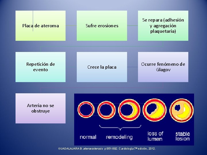 Placa de ateroma Sufre erosiones Se repara (adhesión y agregación plaquetaria) Repetición de evento