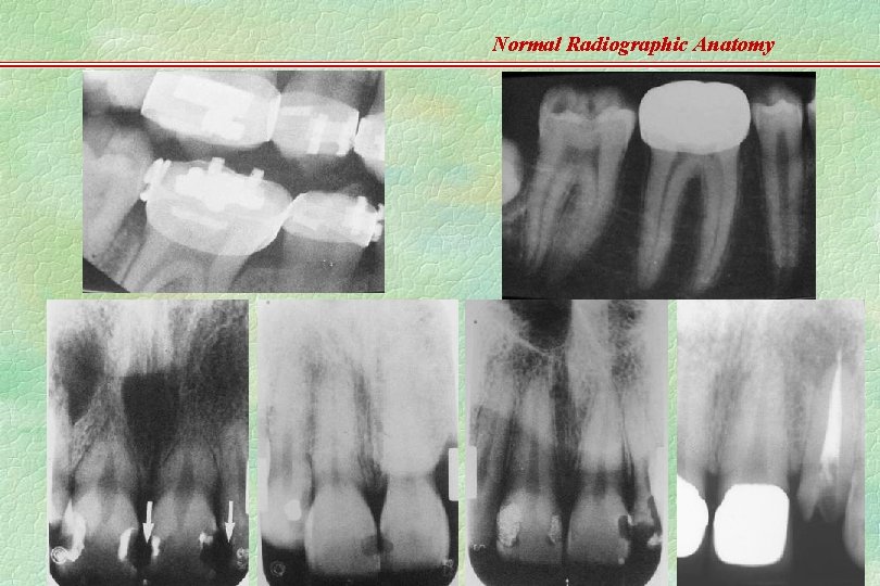 Normal Radiographic Anatomy WWC 