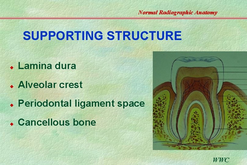 Normal Radiographic Anatomy SUPPORTING STRUCTURE u Lamina dura u Alveolar crest u Periodontal ligament