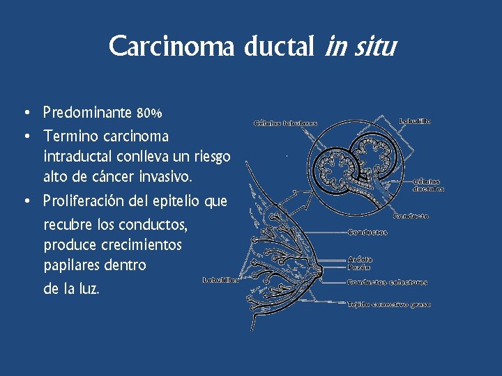 Carcinoma ductal in situ • Predominante 80% • Termino carcinoma intraductal conlleva un riesgo