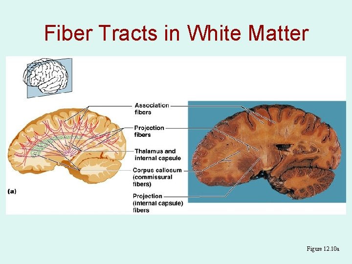 Fiber Tracts in White Matter Figure 12. 10 a 