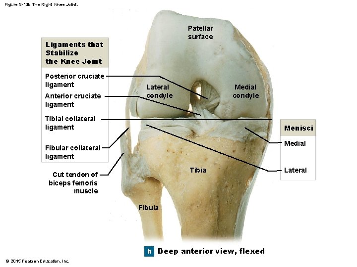 Figure 9 -10 b The Right Knee Joint. Patellar surface Ligaments that Stabilize the Figure 9 -10 b The Right Knee Joint. Patellar surface Ligaments that Stabilize the